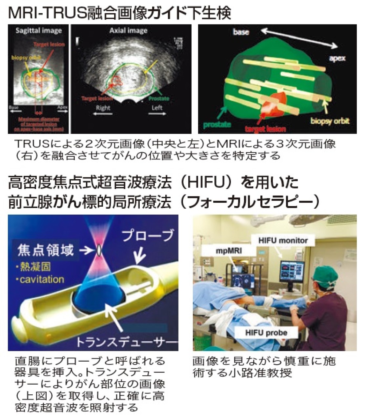 低侵襲・機能温存でQOL向上へ : 東海大学新聞WEB版